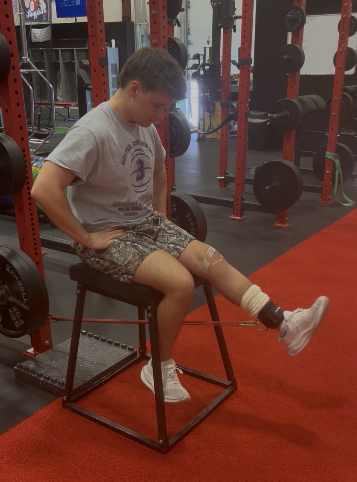 Neuromuscular electrical stimulation therapy session