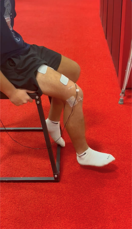 Neuromuscular electrical stimulation therapy session